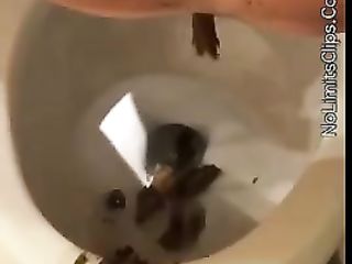 Really Hot Teen Needs To Shit Badly And Lets Out A Bunch Of Runny Shits Out On Webcam