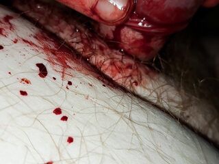 REAL VIRGIN DICK SQUIRTS BLOOD